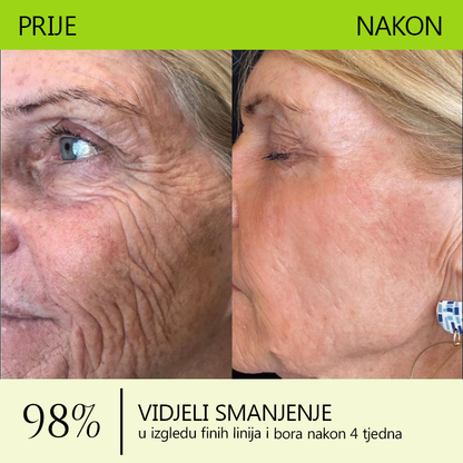 ✨✅𝐕𝐫𝐚𝐭𝐢𝐭𝐞 𝐦𝐥𝐚𝐝𝐨𝐥𝐢𝐤𝐮 𝐤𝐨ž𝐮 𝐬𝐚𝐝𝐚 💫𝐆𝐥𝐢𝐦𝐦𝐞𝐫𝐥𝐲® 𝐁𝐎𝐓𝐎𝐗 & 𝐕𝐈𝐓𝐀𝐌𝐈𝐍 𝐀 𝐋𝐍𝐉𝐄𝐊𝐂𝐈𝐉𝐀 𝐑𝐄𝐓𝐈𝐍𝐎𝐋𝐀 𝐔č𝐯𝐫šć𝐢𝐯𝐚𝐧𝐣𝐞 𝐏𝐫𝐨𝐭𝐢𝐯 𝐛𝐨𝐫𝐚 𝐊𝐫𝐞𝐦𝐚