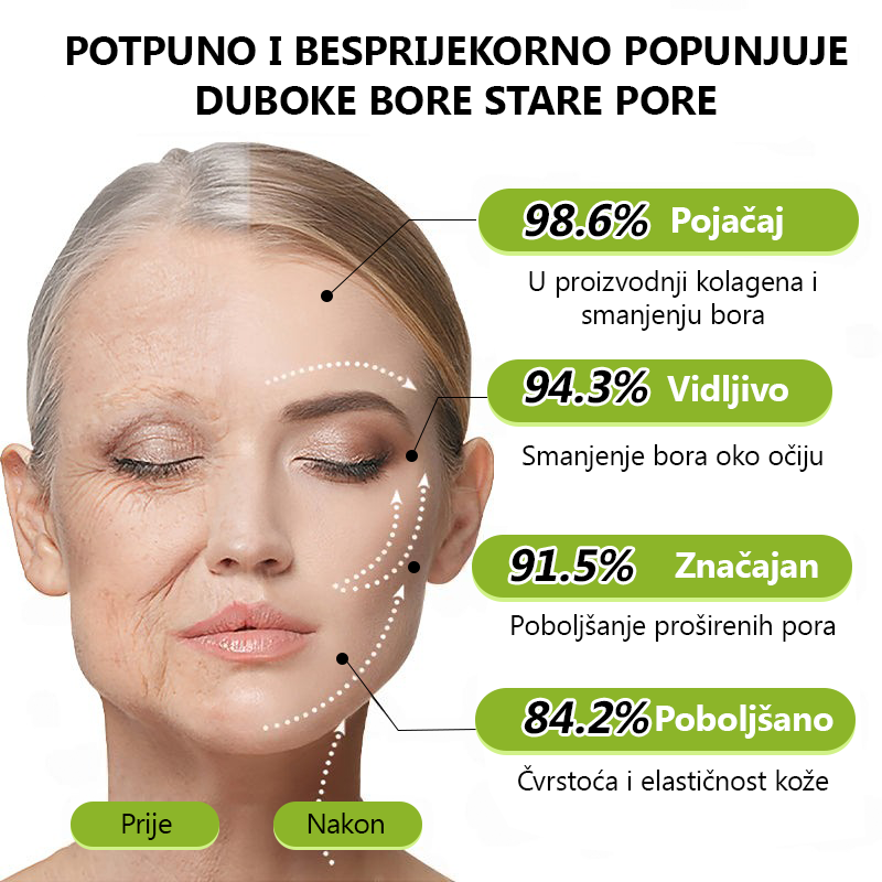 ✨✅𝐕𝐫𝐚𝐭𝐢𝐭𝐞 𝐦𝐥𝐚𝐝𝐨𝐥𝐢𝐤𝐮 𝐤𝐨ž𝐮 𝐬𝐚𝐝𝐚 💫𝐆𝐥𝐢𝐦𝐦𝐞𝐫𝐥𝐲® 𝐁𝐎𝐓𝐎𝐗 & 𝐕𝐈𝐓𝐀𝐌𝐈𝐍 𝐀 𝐋𝐍𝐉𝐄𝐊𝐂𝐈𝐉𝐀 𝐑𝐄𝐓𝐈𝐍𝐎𝐋𝐀 𝐔č𝐯𝐫šć𝐢𝐯𝐚𝐧𝐣𝐞 𝐏𝐫𝐨𝐭𝐢𝐯 𝐛𝐨𝐫𝐚 𝐊𝐫𝐞𝐦𝐚