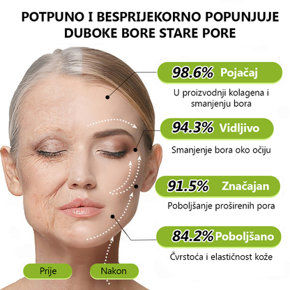 ✨✅𝐕𝐫𝐚𝐭𝐢𝐭𝐞 𝐦𝐥𝐚𝐝𝐨𝐥𝐢𝐤𝐮 𝐤𝐨ž𝐮 𝐬𝐚𝐝𝐚 💫𝐆𝐥𝐢𝐦𝐦𝐞𝐫𝐥𝐲® 𝐁𝐎𝐓𝐎𝐗 & 𝐕𝐈𝐓𝐀𝐌𝐈𝐍 𝐀 𝐋𝐍𝐉𝐄𝐊𝐂𝐈𝐉𝐀 𝐑𝐄𝐓𝐈𝐍𝐎𝐋𝐀 𝐔č𝐯𝐫šć𝐢𝐯𝐚𝐧𝐣𝐞 𝐏𝐫𝐨𝐭𝐢𝐯 𝐛𝐨𝐫𝐚 𝐊𝐫𝐞𝐦𝐚