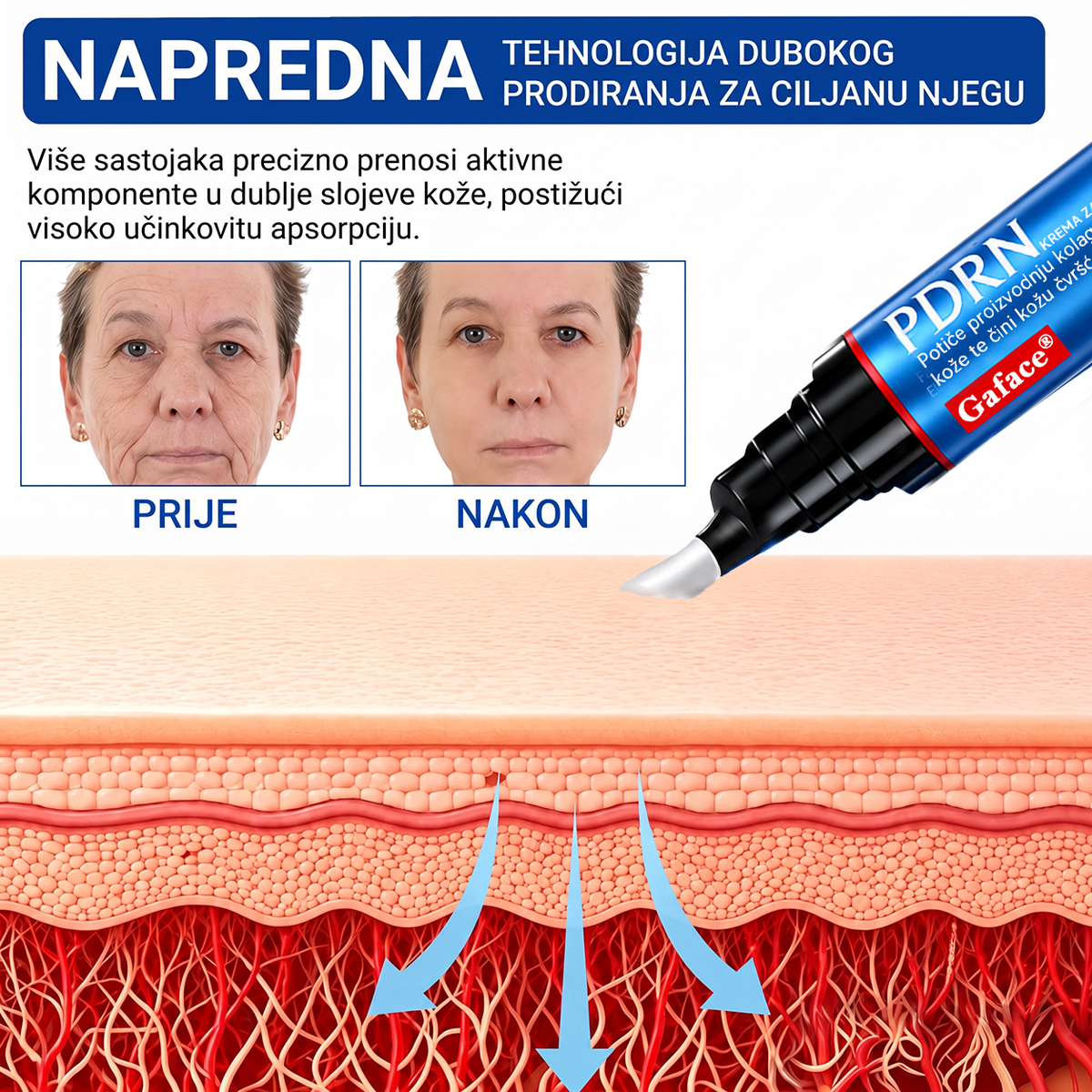 𝑮𝒂𝒇𝒂𝒄𝒆® 👩‍⚕️🔥 𝑃𝐷𝑅𝑁 𝐾𝑅𝐸𝑀𝐴 𝑍𝐴 𝑈Č𝑉𝑅ŠĆ𝐼𝑉𝐴𝑁𝐽𝐸 𝐼 𝑃𝑂𝐷𝐼𝑍𝐴𝑁𝐽𝐸 𝐾𝑂Ž𝐸 𝑃𝑅𝑂𝑇𝐼𝑉 𝐵𝑂𝑅𝐴
