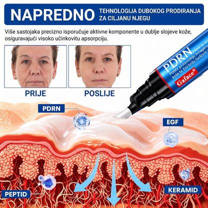 𝑮𝒂𝒇𝒂𝒄𝒆® 👩‍⚕️🔥 𝑃𝐷𝑅𝑁 𝐾𝑅𝐸𝑀𝐴 𝑍𝐴 𝑈Č𝑉𝑅ŠĆ𝐼𝑉𝐴𝑁𝐽𝐸 𝐼 𝑃𝑂𝐷𝐼𝑍𝐴𝑁𝐽𝐸 𝐾𝑂Ž𝐸 𝑃𝑅𝑂𝑇𝐼𝑉 𝐵𝑂𝑅𝐴