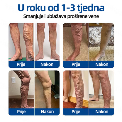✅ Florisma® 🌿 💖 Održiva hidratacija ⚡ Trenutno olakšanje, dugotrajni učinak