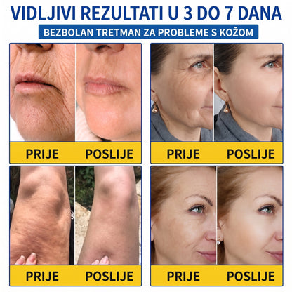 𝑮𝒂𝒇𝒂𝒄𝒆® 👩‍⚕️🔥 𝑃𝐷𝑅𝑁 𝐾𝑅𝐸𝑀𝐴 𝑍𝐴 𝑈Č𝑉𝑅ŠĆ𝐼𝑉𝐴𝑁𝐽𝐸 𝐼 𝑃𝑂𝐷𝐼𝑍𝐴𝑁𝐽𝐸 𝐾𝑂Ž𝐸 𝑃𝑅𝑂𝑇𝐼𝑉 𝐵𝑂𝑅𝐴