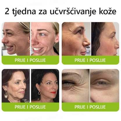 ✨✅𝐕𝐫𝐚𝐭𝐢𝐭𝐞 𝐦𝐥𝐚𝐝𝐨𝐥𝐢𝐤𝐮 𝐤𝐨ž𝐮 𝐬𝐚𝐝𝐚 💫𝐆𝐥𝐢𝐦𝐦𝐞𝐫𝐥𝐲® 𝐁𝐎𝐓𝐎𝐗 & 𝐕𝐈𝐓𝐀𝐌𝐈𝐍 𝐀 𝐋𝐍𝐉𝐄𝐊𝐂𝐈𝐉𝐀 𝐑𝐄𝐓𝐈𝐍𝐎𝐋𝐀 𝐔č𝐯𝐫šć𝐢𝐯𝐚𝐧𝐣𝐞 𝐏𝐫𝐨𝐭𝐢𝐯 𝐛𝐨𝐫𝐚 𝐊𝐫𝐞𝐦𝐚