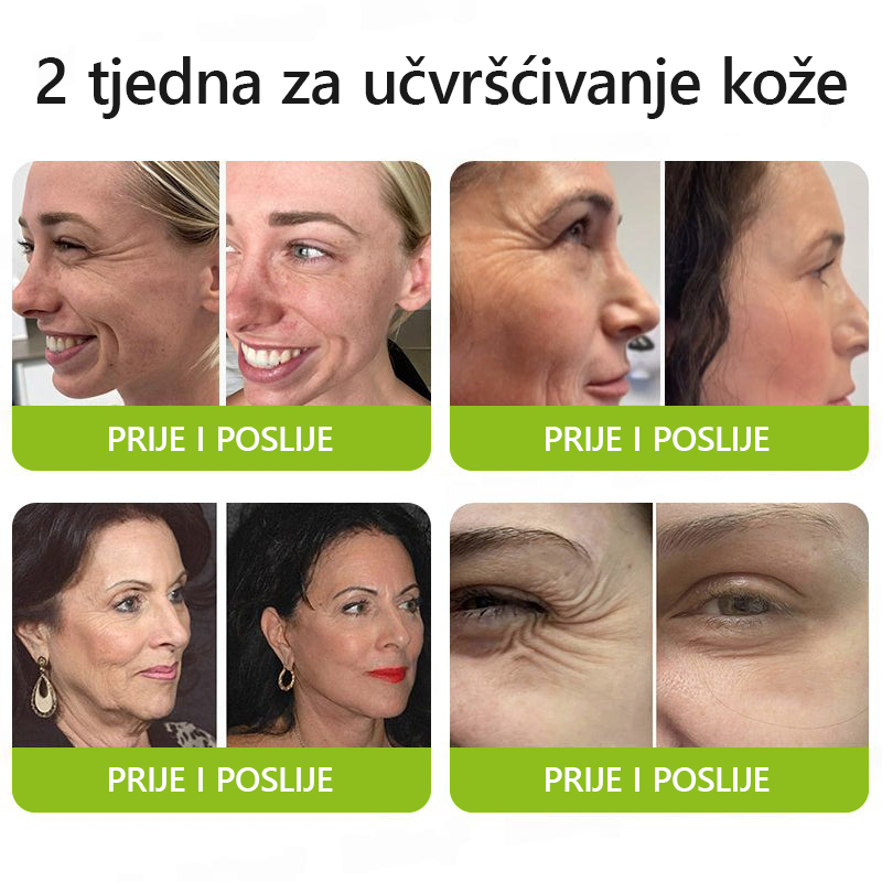 ✨✅𝐕𝐫𝐚𝐭𝐢𝐭𝐞 𝐦𝐥𝐚𝐝𝐨𝐥𝐢𝐤𝐮 𝐤𝐨ž𝐮 𝐬𝐚𝐝𝐚 🍀𝐒𝐓𝐃𝐄𝐈® 𝐁𝐎𝐓𝐎𝐗 & 𝐕𝐈𝐓𝐀𝐌𝐈𝐍 𝐀 𝐋𝐍𝐉𝐄𝐊𝐂𝐈𝐉𝐀 𝐑𝐄𝐓𝐈𝐍𝐎𝐋𝐀 𝐔č𝐯𝐫šć𝐢𝐯𝐚𝐧𝐣𝐞 𝐏𝐫𝐨𝐭𝐢𝐯 𝐛𝐨𝐫𝐚 𝐊𝐫𝐞𝐦𝐚