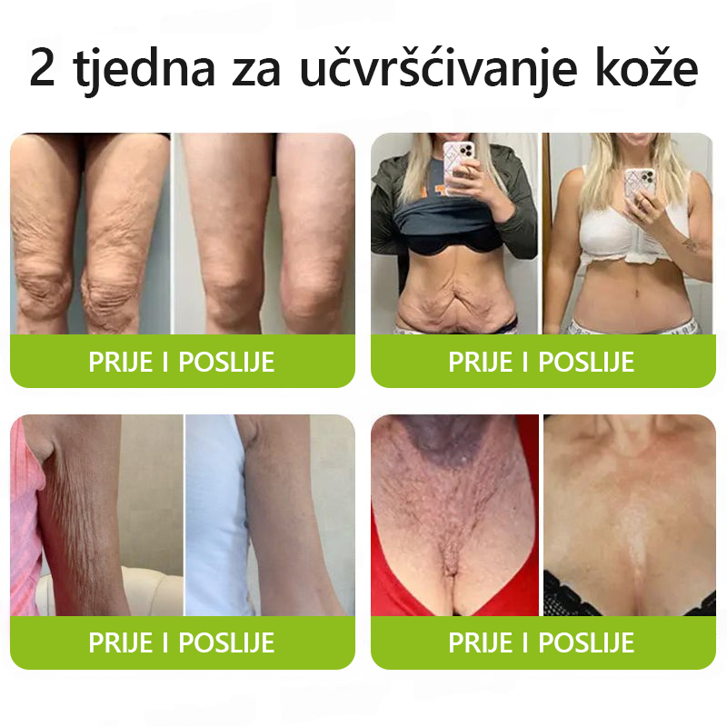 ✨✅𝐕𝐫𝐚𝐭𝐢𝐭𝐞 𝐦𝐥𝐚𝐝𝐨𝐥𝐢𝐤𝐮 𝐤𝐨ž𝐮 𝐬𝐚𝐝𝐚 💫𝐆𝐥𝐢𝐦𝐦𝐞𝐫𝐥𝐲® 𝐁𝐎𝐓𝐎𝐗 & 𝐕𝐈𝐓𝐀𝐌𝐈𝐍 𝐀 𝐋𝐍𝐉𝐄𝐊𝐂𝐈𝐉𝐀 𝐑𝐄𝐓𝐈𝐍𝐎𝐋𝐀 𝐔č𝐯𝐫šć𝐢𝐯𝐚𝐧𝐣𝐞 𝐏𝐫𝐨𝐭𝐢𝐯 𝐛𝐨𝐫𝐚 𝐊𝐫𝐞𝐦𝐚