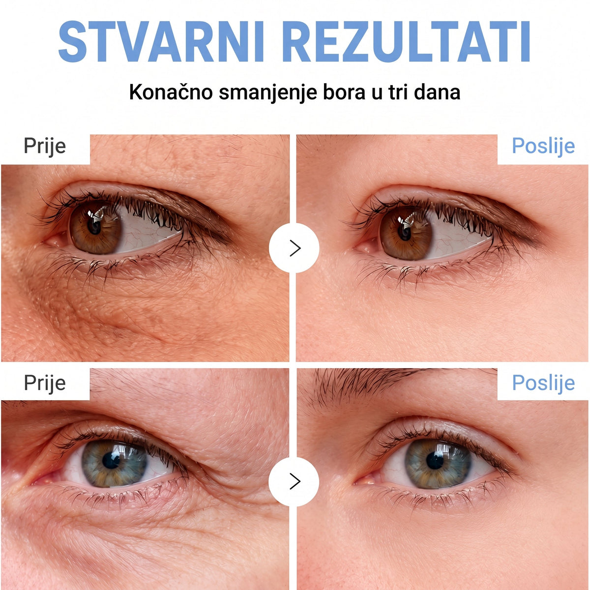 𝑮𝒂𝒇𝒂𝒄𝒆® 👩‍⚕️🔥 𝑃𝐷𝑅𝑁 𝐾𝑅𝐸𝑀𝐴 𝑍𝐴 𝑈Č𝑉𝑅ŠĆ𝐼𝑉𝐴𝑁𝐽𝐸 𝐼 𝑃𝑂𝐷𝐼𝑍𝐴𝑁𝐽𝐸 𝐾𝑂Ž𝐸 𝑃𝑅𝑂𝑇𝐼𝑉 𝐵𝑂𝑅𝐴