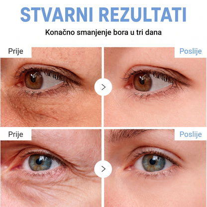 𝑮𝒂𝒇𝒂𝒄𝒆® 👩‍⚕️🔥 𝑃𝐷𝑅𝑁 𝐾𝑅𝐸𝑀𝐴 𝑍𝐴 𝑈Č𝑉𝑅ŠĆ𝐼𝑉𝐴𝑁𝐽𝐸 𝐼 𝑃𝑂𝐷𝐼𝑍𝐴𝑁𝐽𝐸 𝐾𝑂Ž𝐸 𝑃𝑅𝑂𝑇𝐼𝑉 𝐵𝑂𝑅𝐴