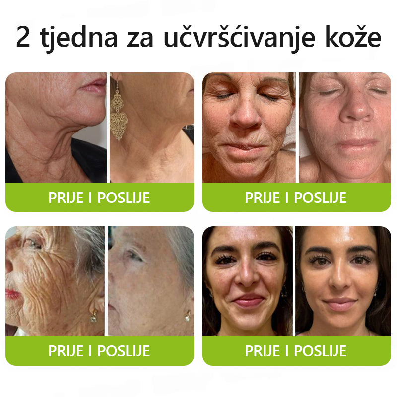 ✨✅𝐕𝐫𝐚𝐭𝐢𝐭𝐞 𝐦𝐥𝐚𝐝𝐨𝐥𝐢𝐤𝐮 𝐤𝐨ž𝐮 𝐬𝐚𝐝𝐚 💫𝐆𝐥𝐢𝐦𝐦𝐞𝐫𝐥𝐲® 𝐁𝐎𝐓𝐎𝐗 & 𝐕𝐈𝐓𝐀𝐌𝐈𝐍 𝐀 𝐋𝐍𝐉𝐄𝐊𝐂𝐈𝐉𝐀 𝐑𝐄𝐓𝐈𝐍𝐎𝐋𝐀 𝐔č𝐯𝐫šć𝐢𝐯𝐚𝐧𝐣𝐞 𝐏𝐫𝐨𝐭𝐢𝐯 𝐛𝐨𝐫𝐚 𝐊𝐫𝐞𝐦𝐚
