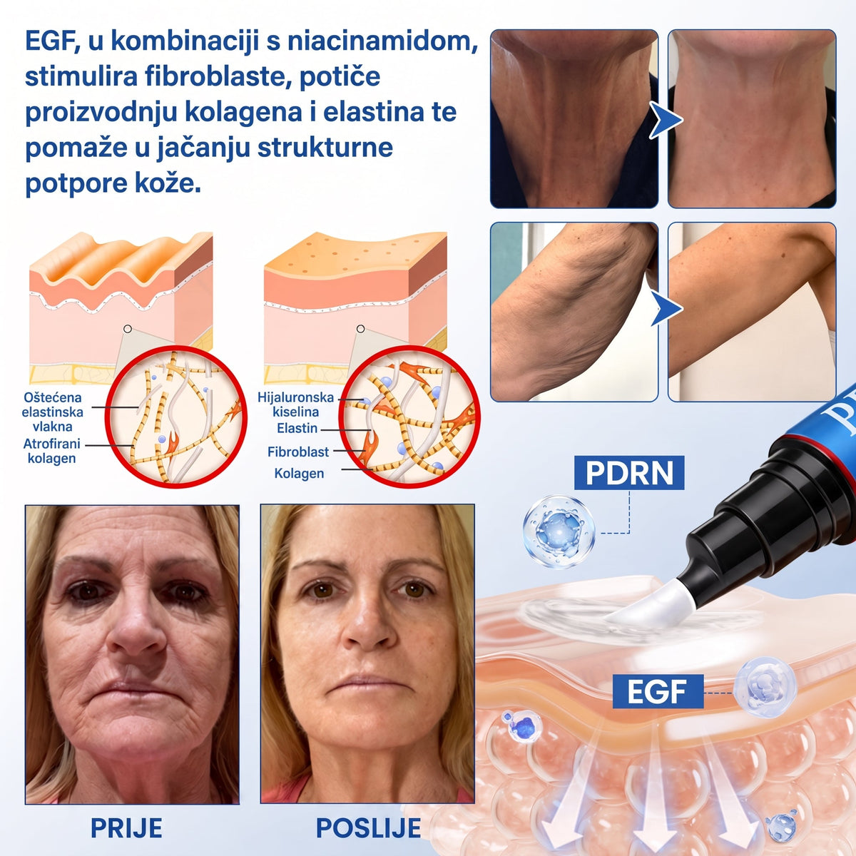𝑮𝒂𝒇𝒂𝒄𝒆® 👩‍⚕️🔥 𝑃𝐷𝑅𝑁 𝐾𝑅𝐸𝑀𝐴 𝑍𝐴 𝑈Č𝑉𝑅ŠĆ𝐼𝑉𝐴𝑁𝐽𝐸 𝐼 𝑃𝑂𝐷𝐼𝑍𝐴𝑁𝐽𝐸 𝐾𝑂Ž𝐸 𝑃𝑅𝑂𝑇𝐼𝑉 𝐵𝑂𝑅𝐴