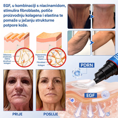 𝑮𝒂𝒇𝒂𝒄𝒆® 👩‍⚕️🔥 𝑃𝐷𝑅𝑁 𝐾𝑅𝐸𝑀𝐴 𝑍𝐴 𝑈Č𝑉𝑅ŠĆ𝐼𝑉𝐴𝑁𝐽𝐸 𝐼 𝑃𝑂𝐷𝐼𝑍𝐴𝑁𝐽𝐸 𝐾𝑂Ž𝐸 𝑃𝑅𝑂𝑇𝐼𝑉 𝐵𝑂𝑅𝐴