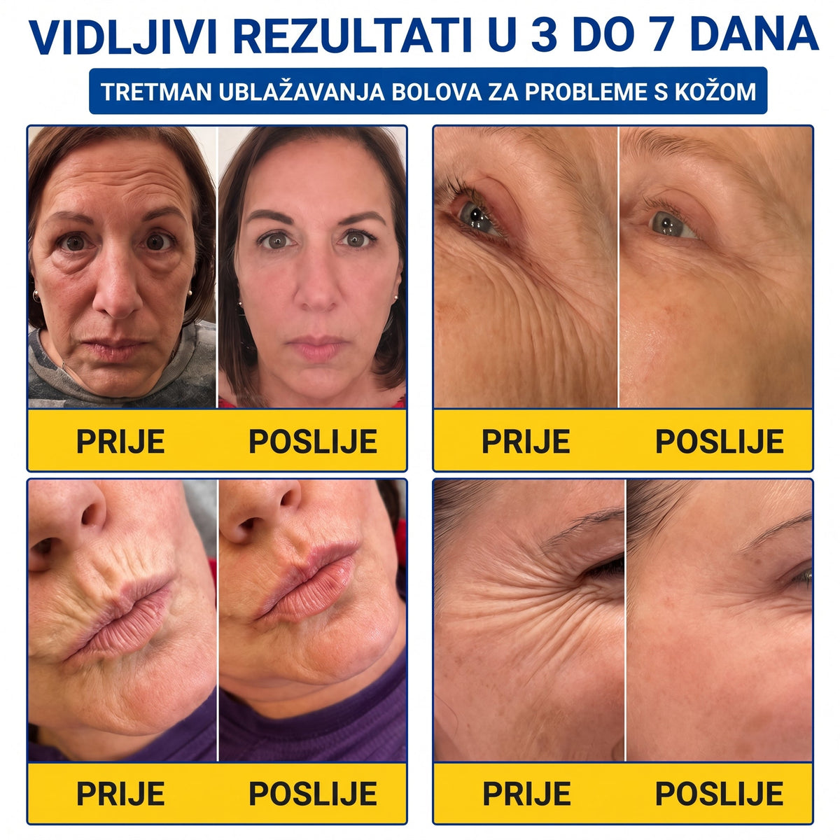 𝑮𝒂𝒇𝒂𝒄𝒆® 👩‍⚕️🔥 𝑃𝐷𝑅𝑁 𝐾𝑅𝐸𝑀𝐴 𝑍𝐴 𝑈Č𝑉𝑅ŠĆ𝐼𝑉𝐴𝑁𝐽𝐸 𝐼 𝑃𝑂𝐷𝐼𝑍𝐴𝑁𝐽𝐸 𝐾𝑂Ž𝐸 𝑃𝑅𝑂𝑇𝐼𝑉 𝐵𝑂𝑅𝐴