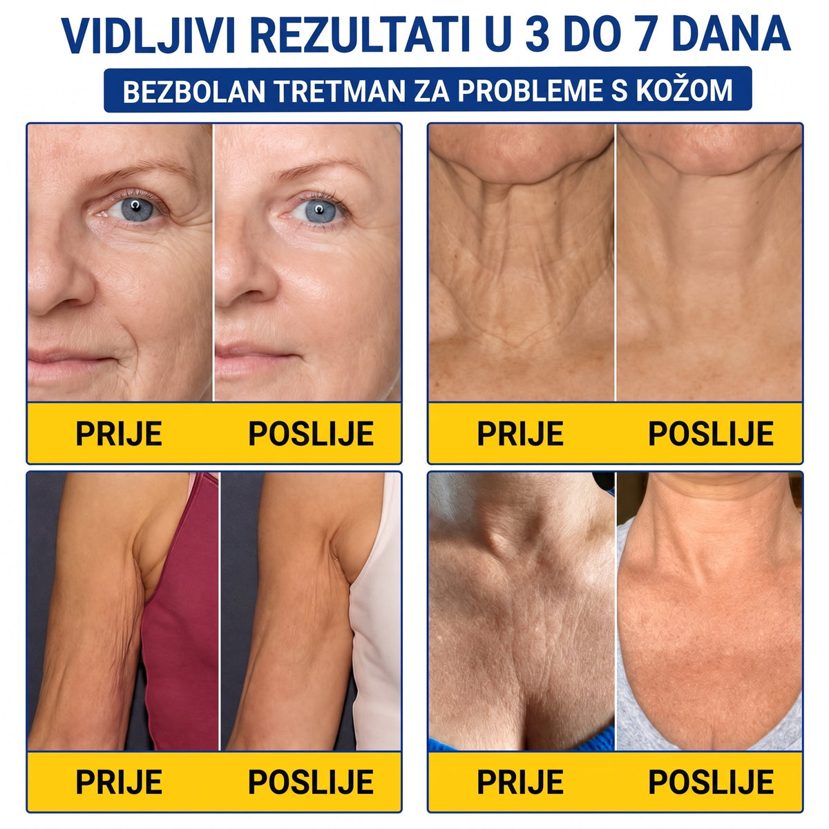 𝑮𝒂𝒇𝒂𝒄𝒆® 👩‍⚕️🔥 𝑃𝐷𝑅𝑁 𝐾𝑅𝐸𝑀𝐴 𝑍𝐴 𝑈Č𝑉𝑅ŠĆ𝐼𝑉𝐴𝑁𝐽𝐸 𝐼 𝑃𝑂𝐷𝐼𝑍𝐴𝑁𝐽𝐸 𝐾𝑂Ž𝐸 𝑃𝑅𝑂𝑇𝐼𝑉 𝐵𝑂𝑅𝐴