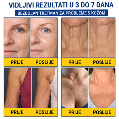 𝑮𝒂𝒇𝒂𝒄𝒆® 👩‍⚕️🔥 𝑃𝐷𝑅𝑁 𝐾𝑅𝐸𝑀𝐴 𝑍𝐴 𝑈Č𝑉𝑅ŠĆ𝐼𝑉𝐴𝑁𝐽𝐸 𝐼 𝑃𝑂𝐷𝐼𝑍𝐴𝑁𝐽𝐸 𝐾𝑂Ž𝐸 𝑃𝑅𝑂𝑇𝐼𝑉 𝐵𝑂𝑅𝐴