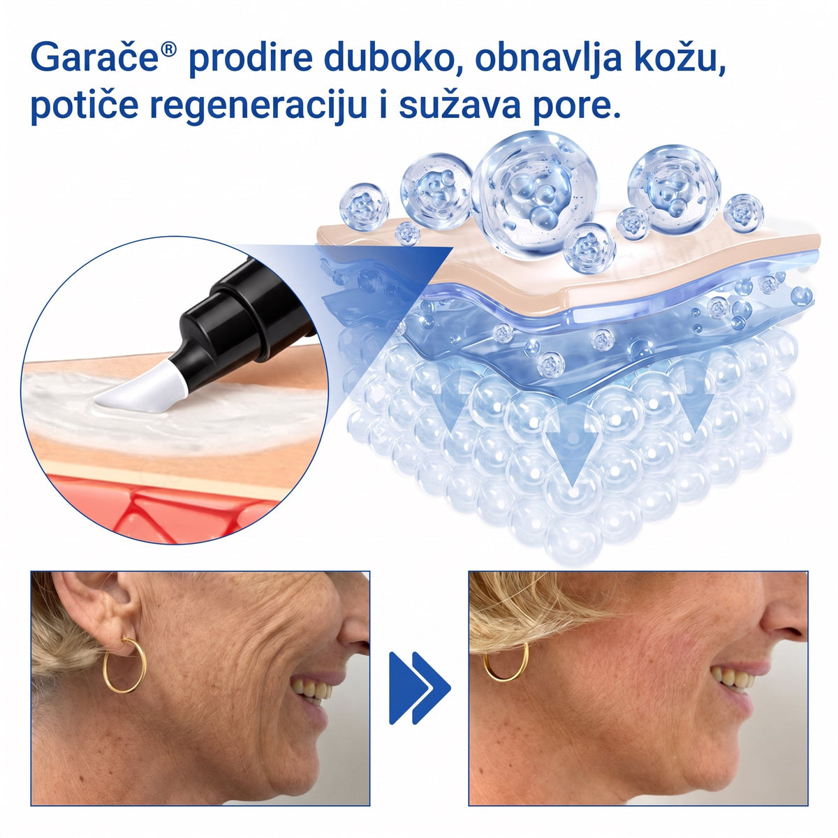 𝑮𝒂𝒇𝒂𝒄𝒆® 👩‍⚕️🔥 𝑃𝐷𝑅𝑁 𝐾𝑅𝐸𝑀𝐴 𝑍𝐴 𝑈Č𝑉𝑅ŠĆ𝐼𝑉𝐴𝑁𝐽𝐸 𝐼 𝑃𝑂𝐷𝐼𝑍𝐴𝑁𝐽𝐸 𝐾𝑂Ž𝐸 𝑃𝑅𝑂𝑇𝐼𝑉 𝐵𝑂𝑅𝐴